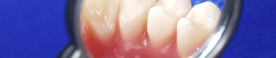 periodontal-gum-care